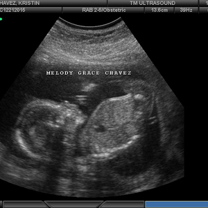 Fundraising Page: Kristin Chavez